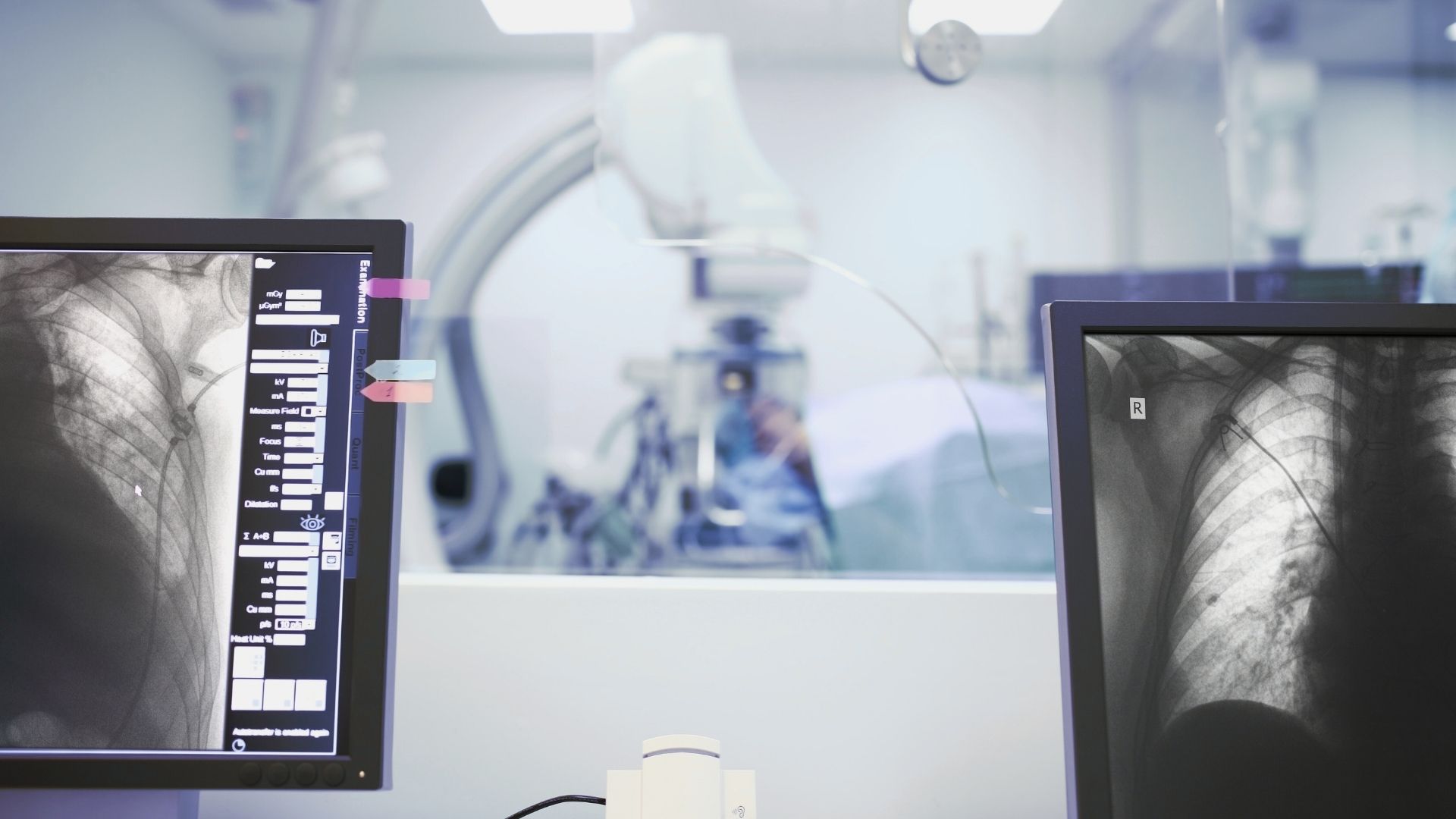 Sicht auf zwei Röntgenmonitore mittig eine Liegendaufnahme